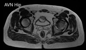 Axial sections of the T1WI