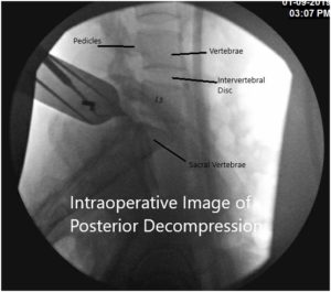 Imagen fluoroscópica intraoperatoria