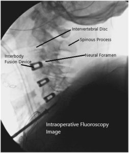 Intraoperative fluoroscopic images