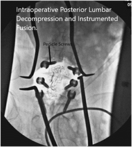 Intraoperative fluoroscopy images