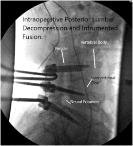 Intraoperative fluoroscopy images 2