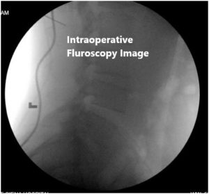 Intraoperative fluoroscopic images