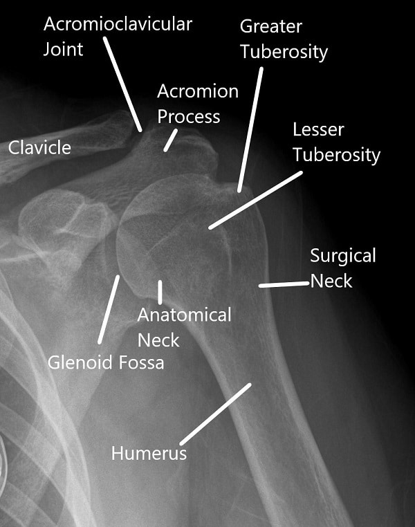 X-ray of the shoulder in AP view