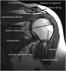 X-ray of the shoulder in AP view