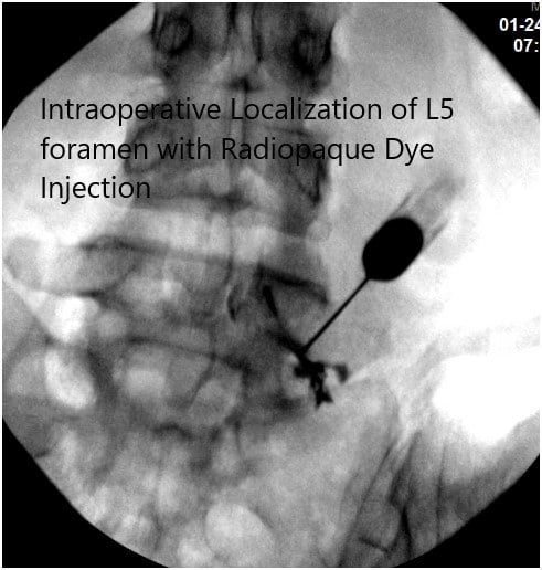 Fluoroscopia intraoperatoria Imágenes 2