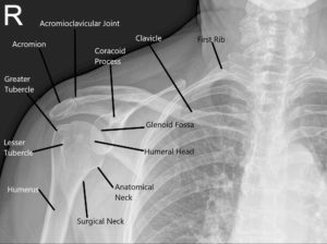 Radiografía que muestra la anatomía normal del hombro