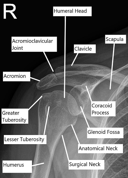 Radiografía que muestra la anatomía normal del hombro