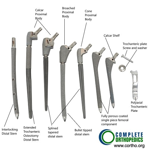 Revision Hip Replacement Femoral Components.
