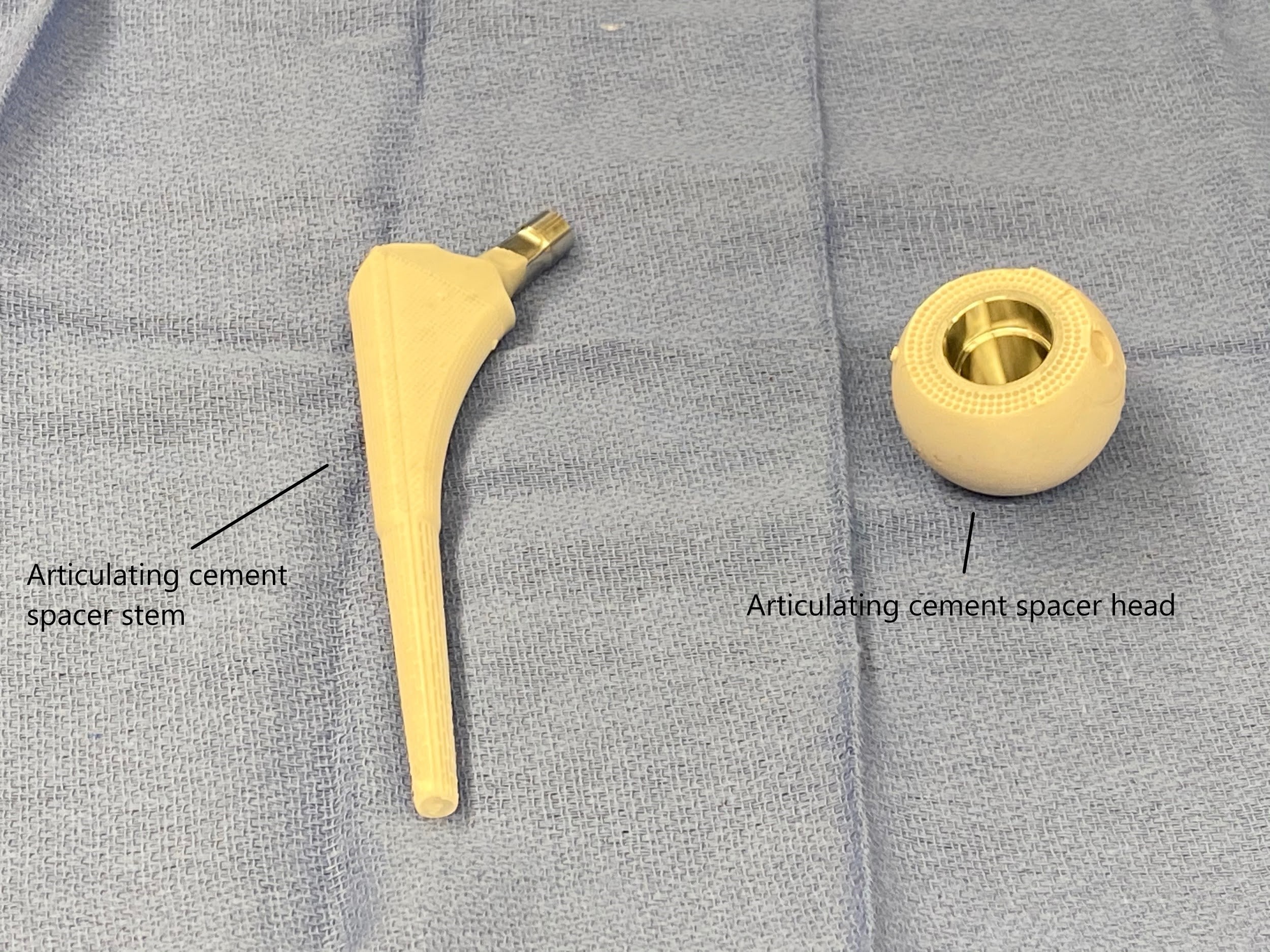 Articular cabezal espaciador de cemento y vástago antes de la implantación
