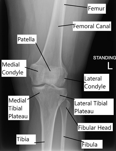Radiografía que muestra la anatomía de la rodilla.