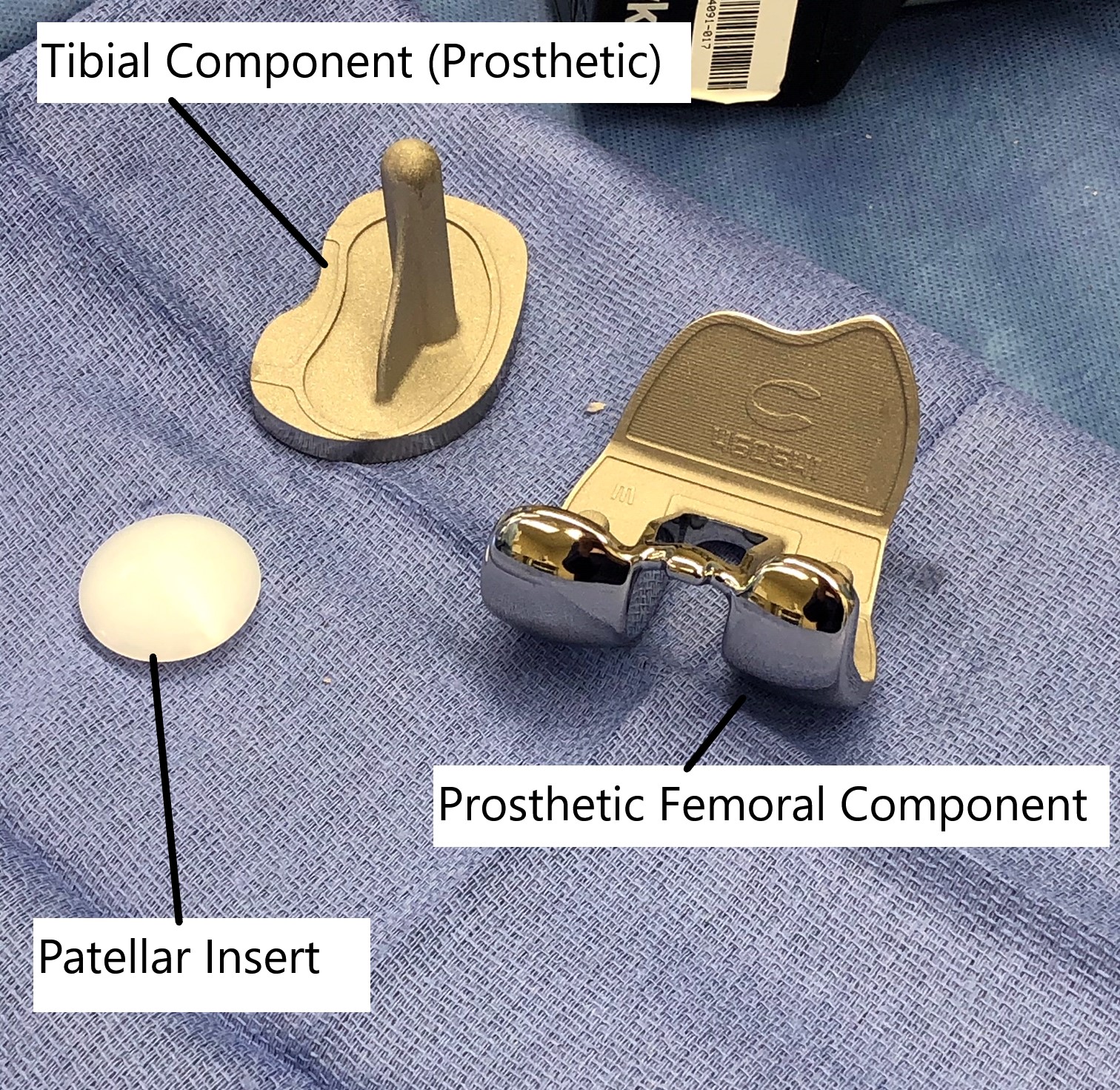 Knee arthroplasty implants