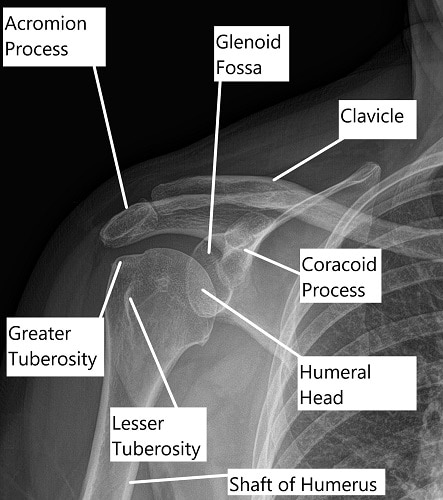 Radiografía que muestra la anatomía del hombro
