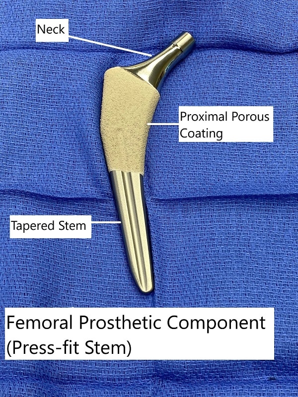 prosthetic stem