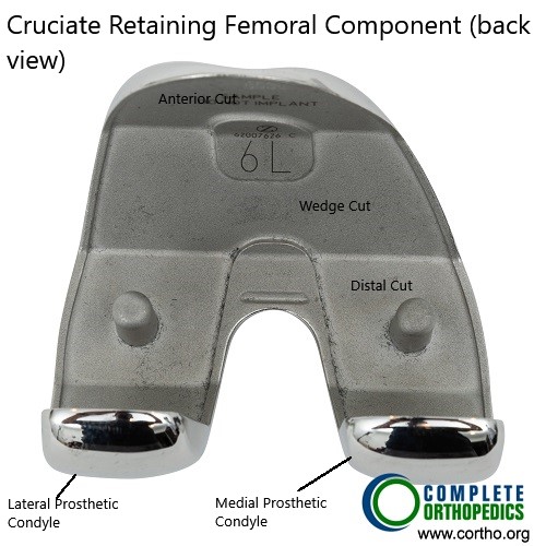 Cruciate retaining femoral component