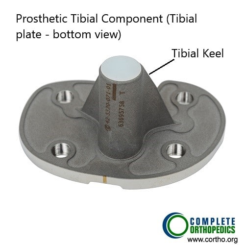 Tibial component (undersurface)