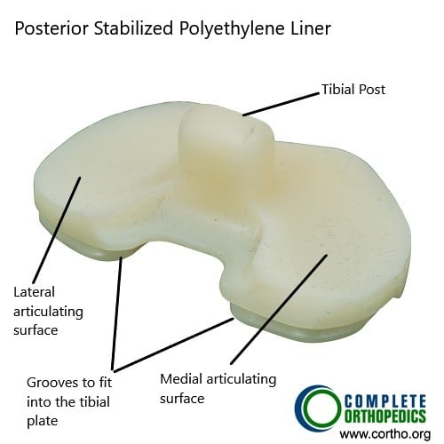Polyethylene Insert (Posterior Stabilized)