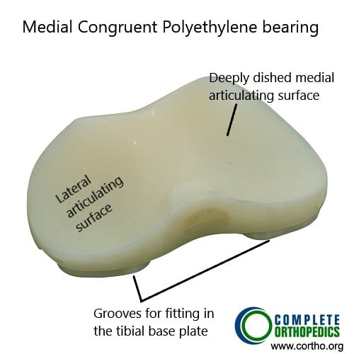 Medial congruent polyethylene insert