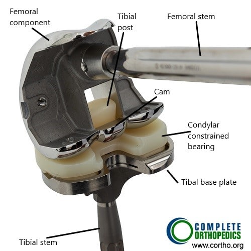 Revision knee modular components