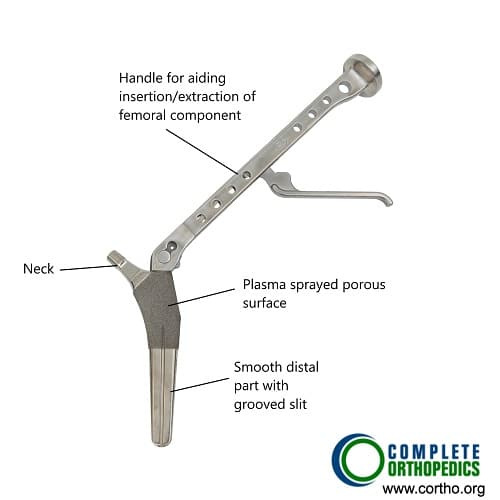 Femoral Component in Primary Hip Replacement
