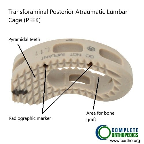 Transforaminal atraumatic lumbar interbody fusion cage