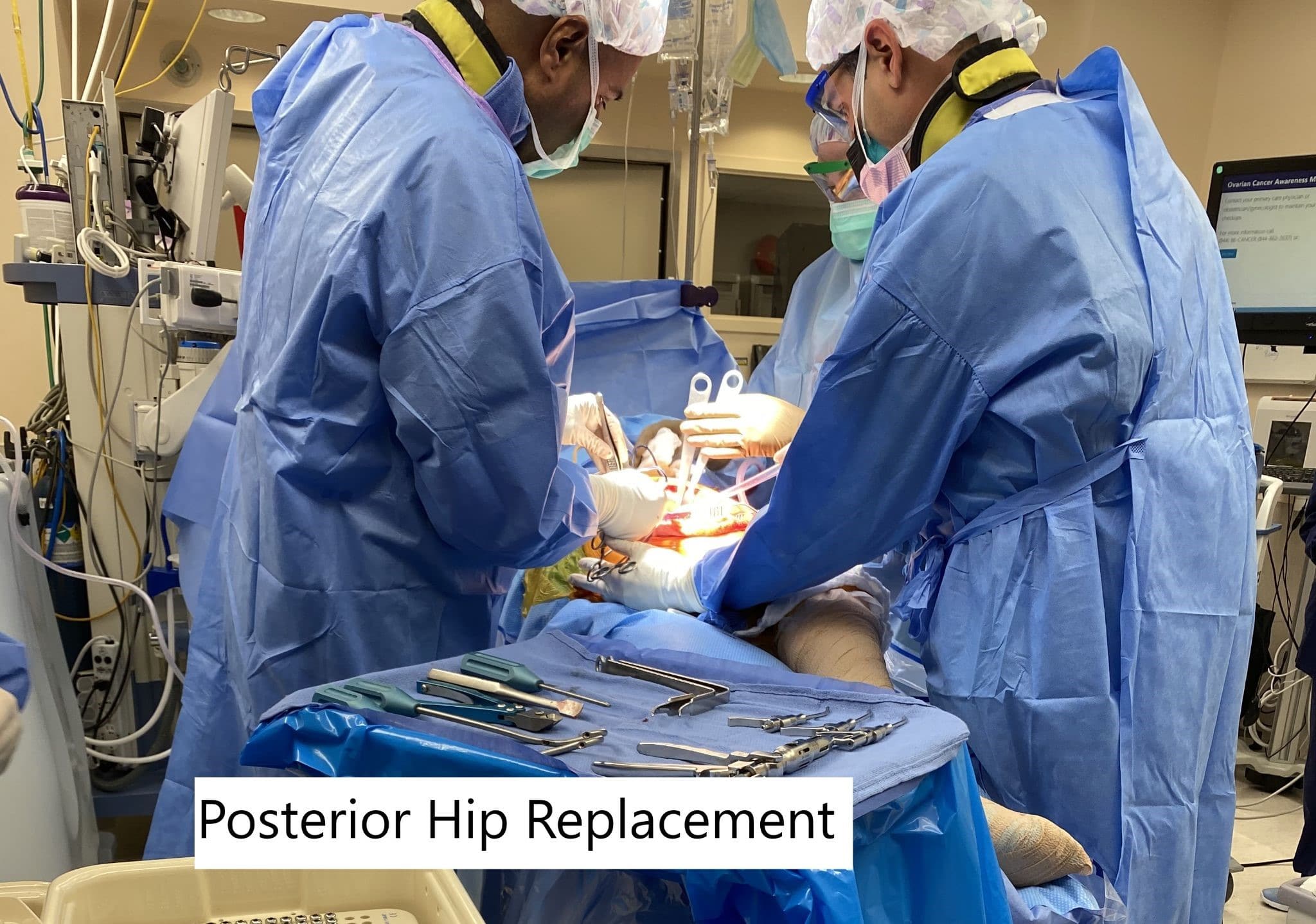 Intraoperative image showing posterior hip replacement.