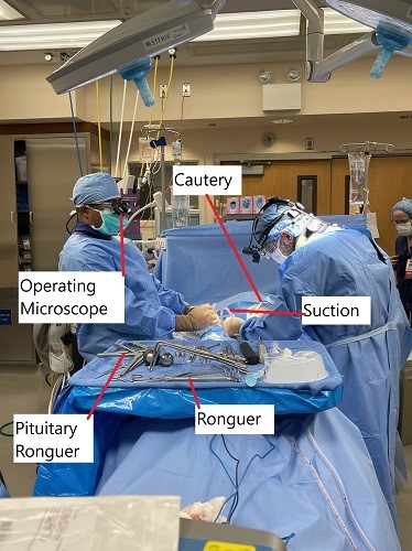 Intraoperative image showing microdiscectomy surgery.