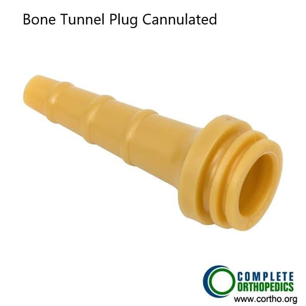 Bone tunnel plug used in ACL reconstruction.