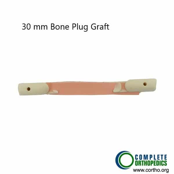 Bone plug graft used in ACL reconstruction.