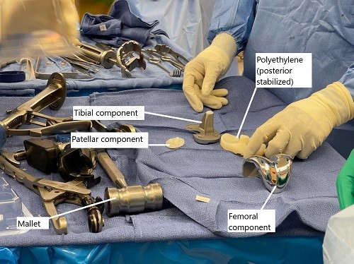 Intraoperative image showing prosthetic component.