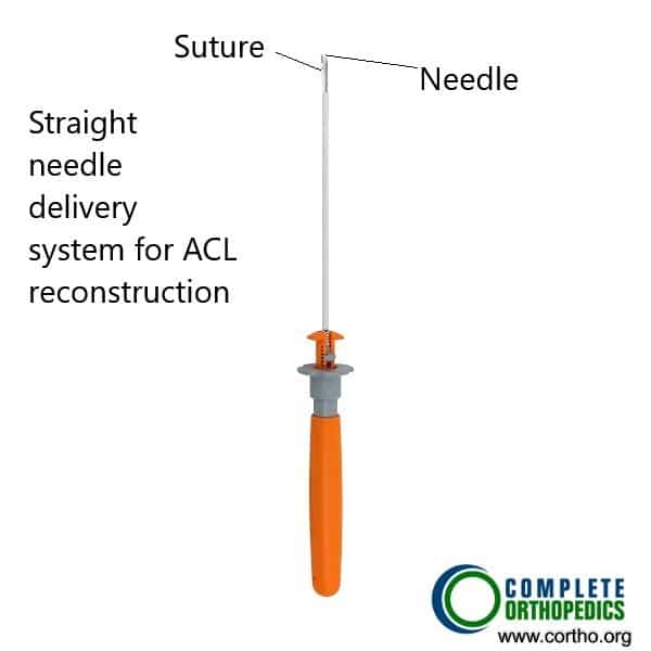 Instruments used in knee arthroscopic surgery.