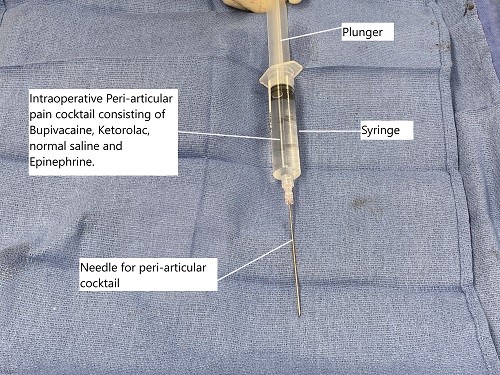 Intraoperative cocktail for peri-articular injection used for pain control after the surgery.