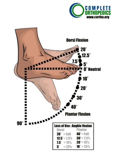 Scheduled Loss of Use for Ankle and Foot - Complete Orthopedics