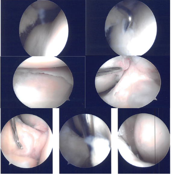 Imágenes intraoperatorias